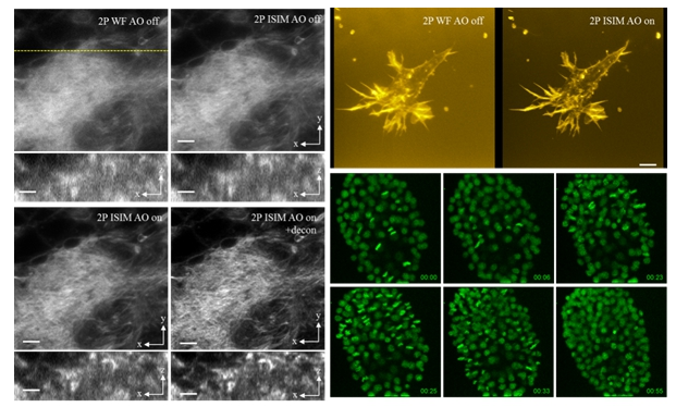 先进院超分辨光学显微成像方面取得重大突破